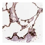 Merck Anti-STEAP1 antibody produced in rabbit