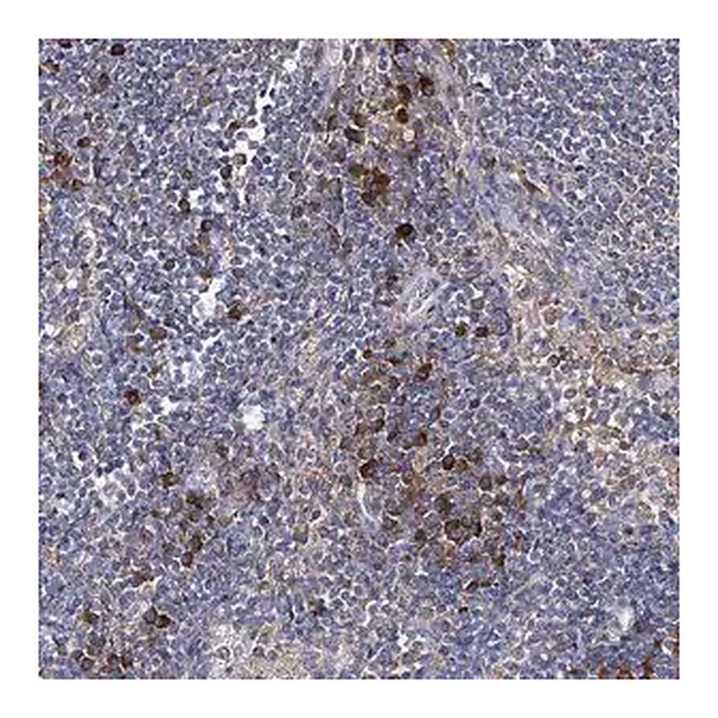 Merck Anti-IL1RAP antibody produced in rabbit