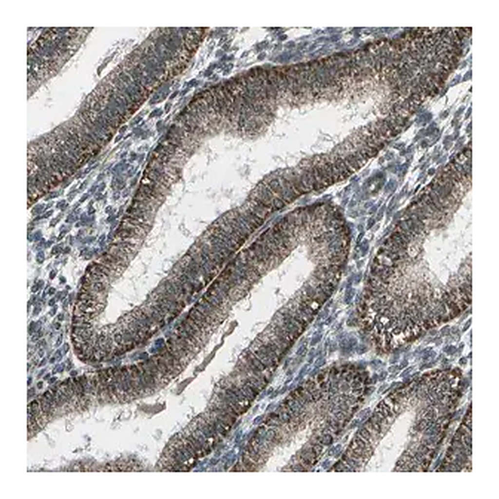 Merck Anti-EIF2AK1 antibody produced in rabbit