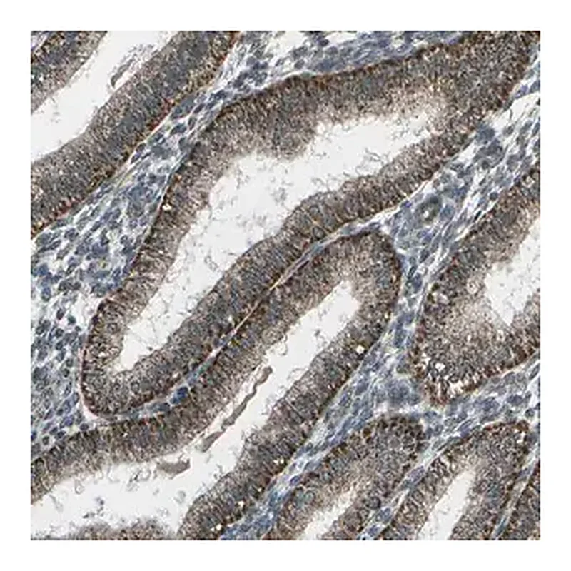 Merck Anti-EIF2AK1 antibody produced in rabbit