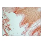Merck Anti-Fibroblast Growth Factor Receptor-1 antibody produced in rabbit