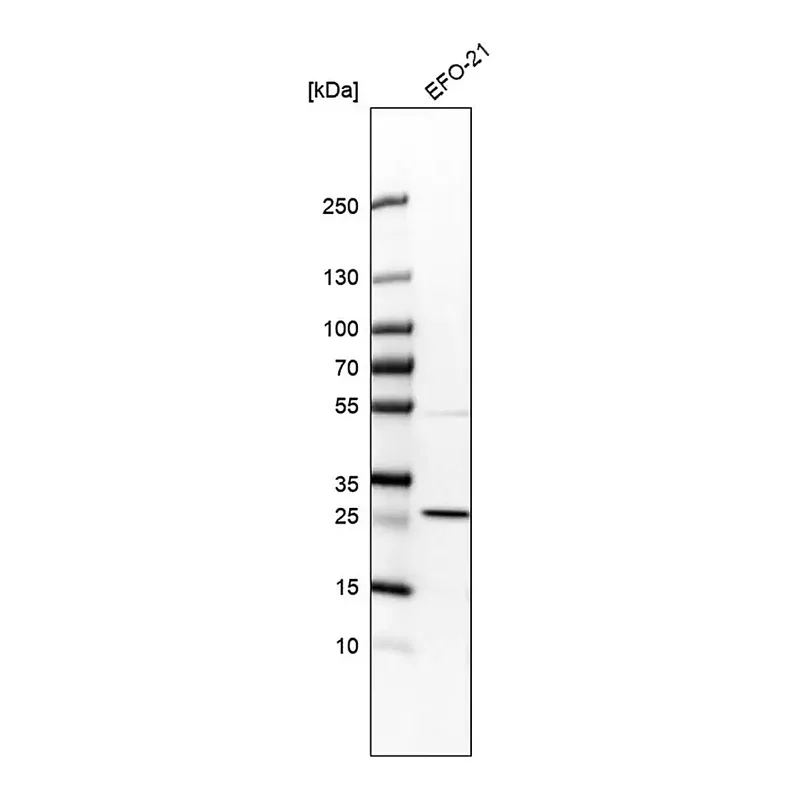 Merck Anti-RIT1 antibody produced in rabbit