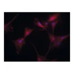 Merck Anti-Transglutaminase-2 (C-terminal) antibody produced in rabbit