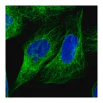 Merck Anti-LARP6 antibody produced in rabbit