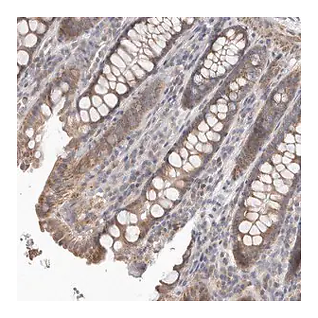 Merck Anti-UNK antibody produced in rabbit