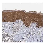 Merck Anti-IL11RA antibody produced in rabbit