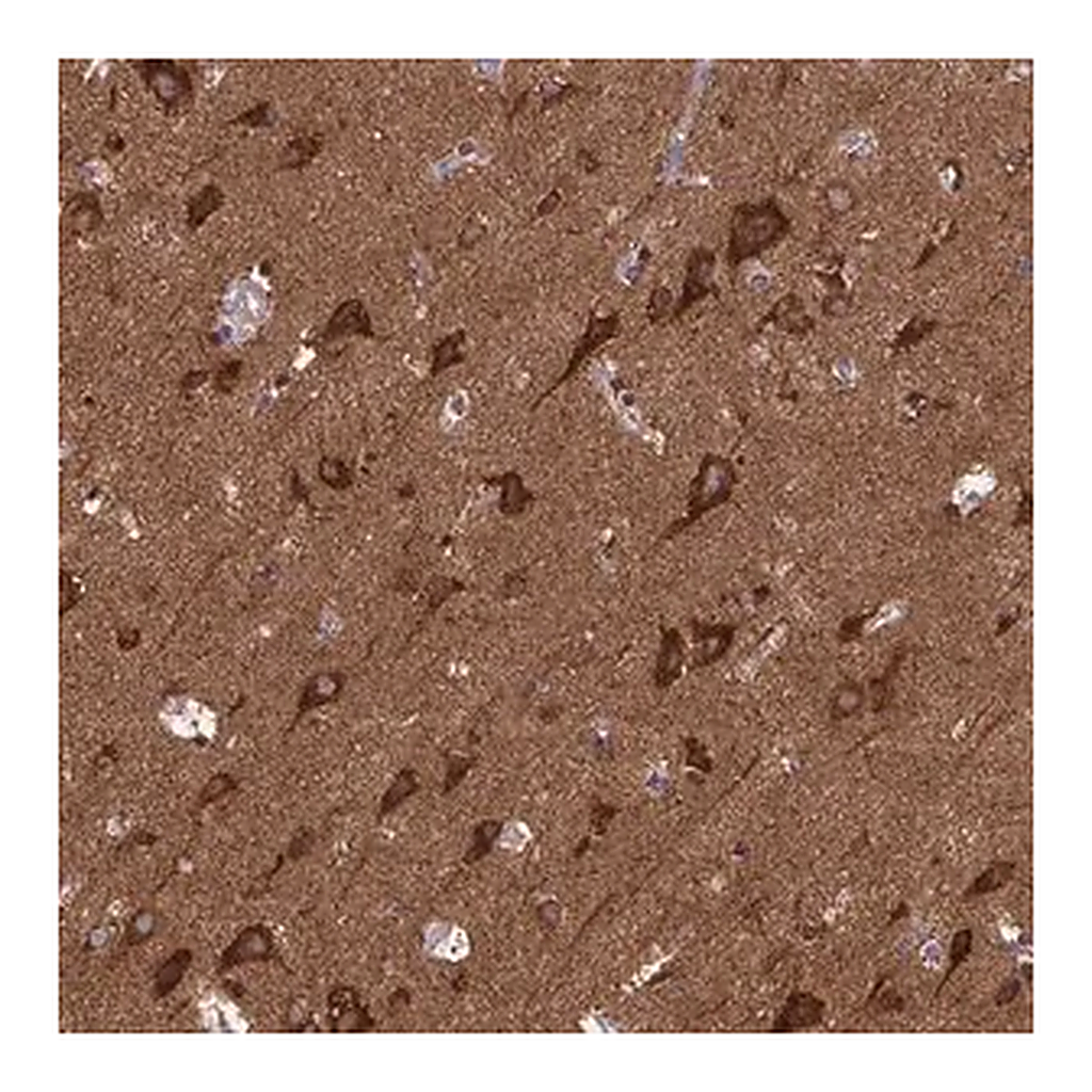 Merck Anti-MCCC1 antibody produced in rabbit
