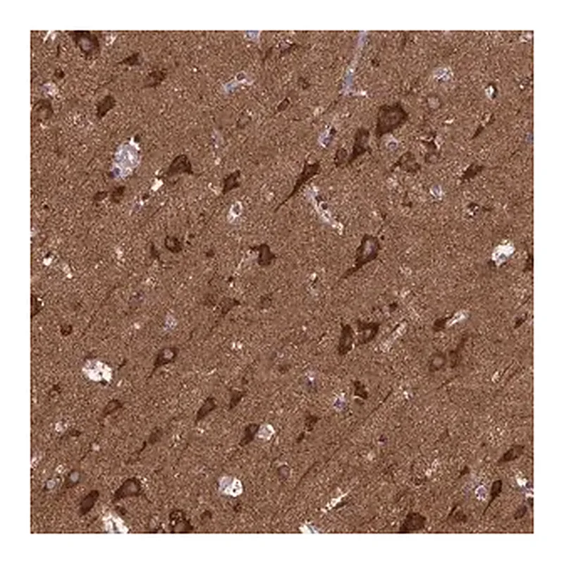 Merck Anti-MCCC1 antibody produced in rabbit