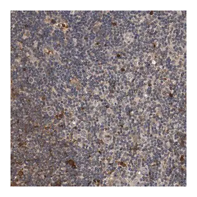Merck Anti-TNFRSF1B antibody produced in rabbit