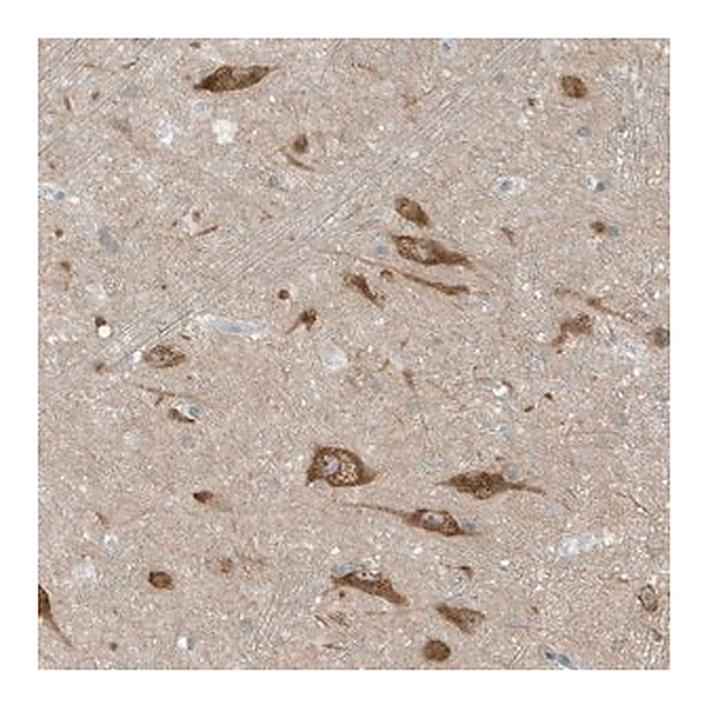 Merck Anti-SCN3A antibody produced in rabbit