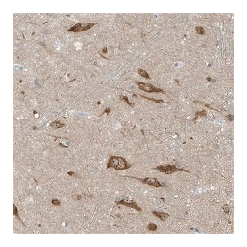 Merck Anti-SCN3A antibody produced in rabbit