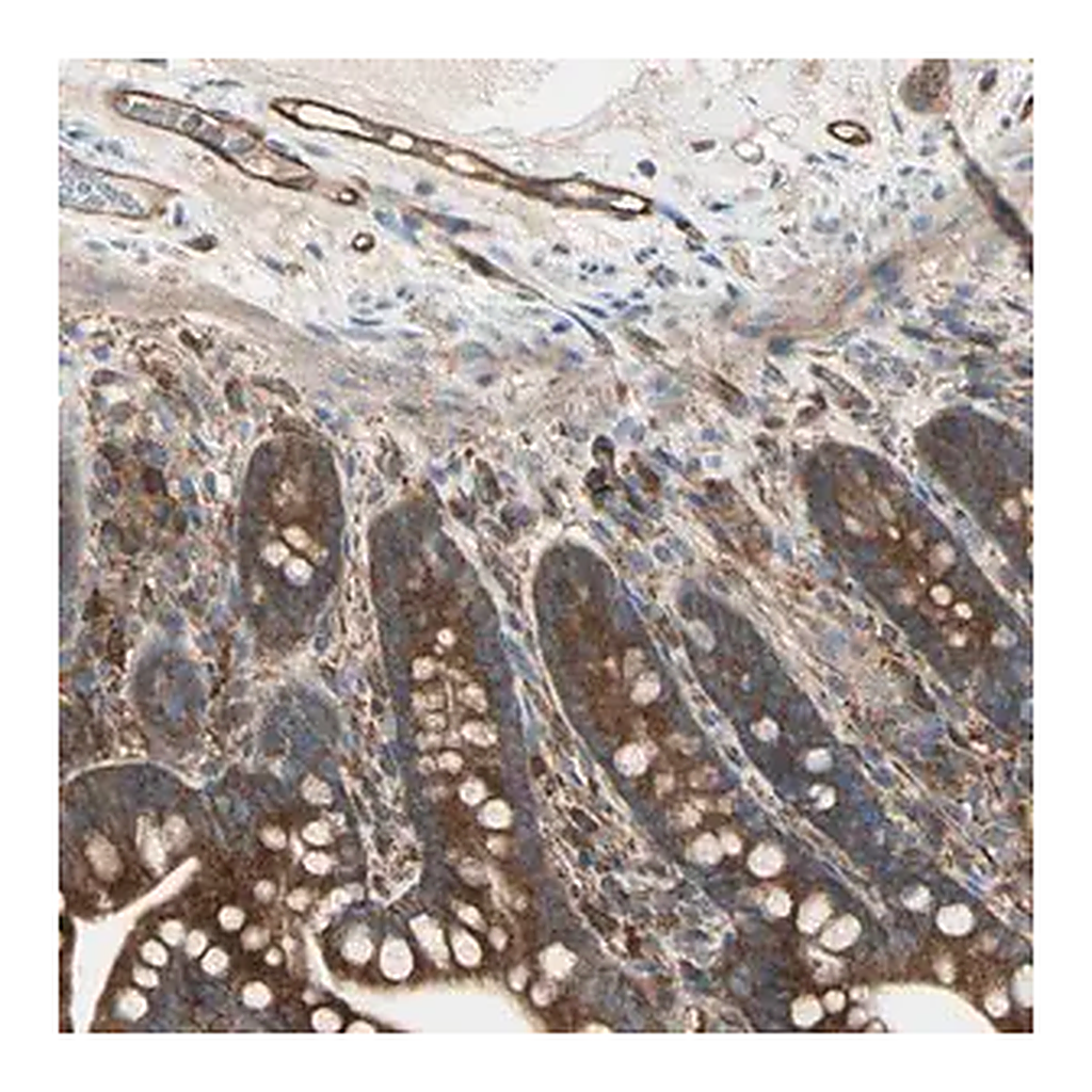 Merck Anti-IGSF9B antibody produced in rabbit