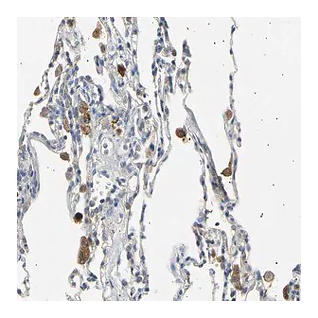 Merck Anti-LDLR antibody produced in rabbit