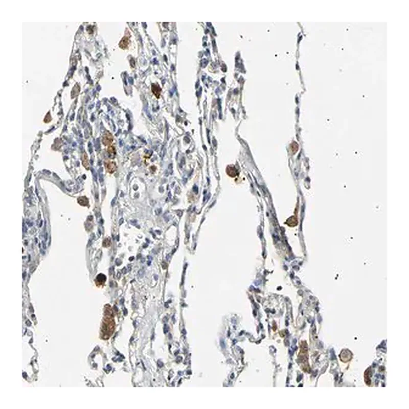 Merck Anti-LDLR antibody produced in rabbit