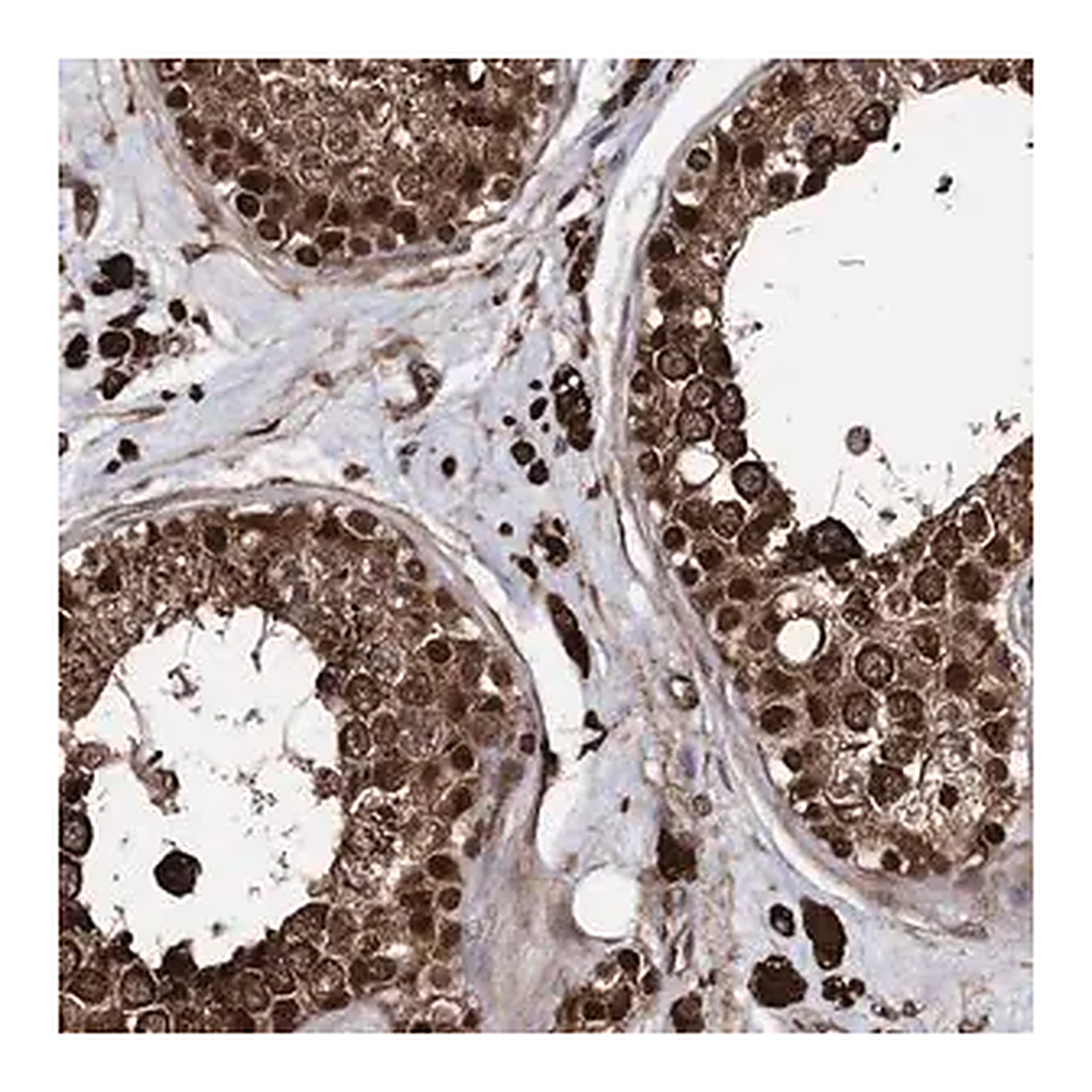 Merck Anti-ANKRD12 antibody produced in rabbit