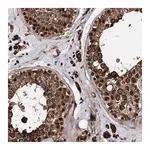 Merck Anti-ANKRD12 antibody produced in rabbit