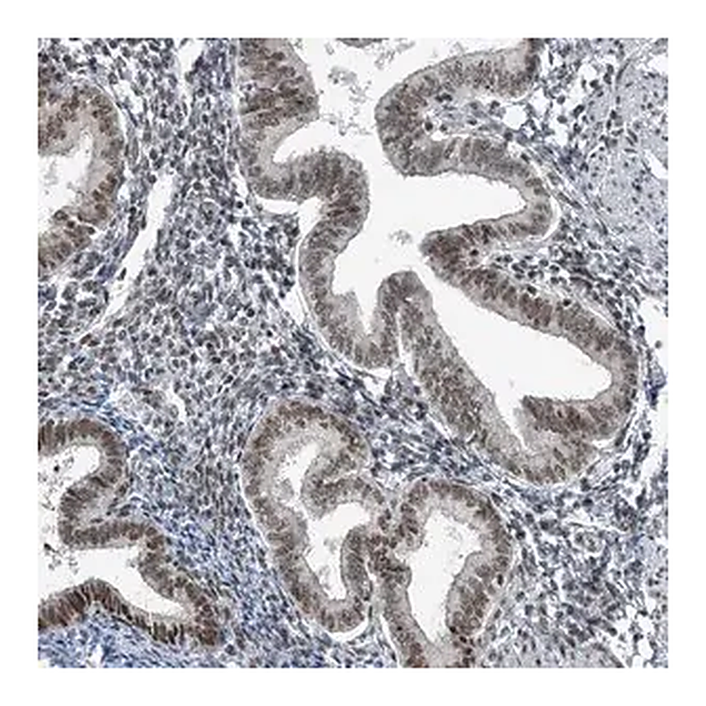 Merck Anti-YTHDC1 antibody produced in rabbit