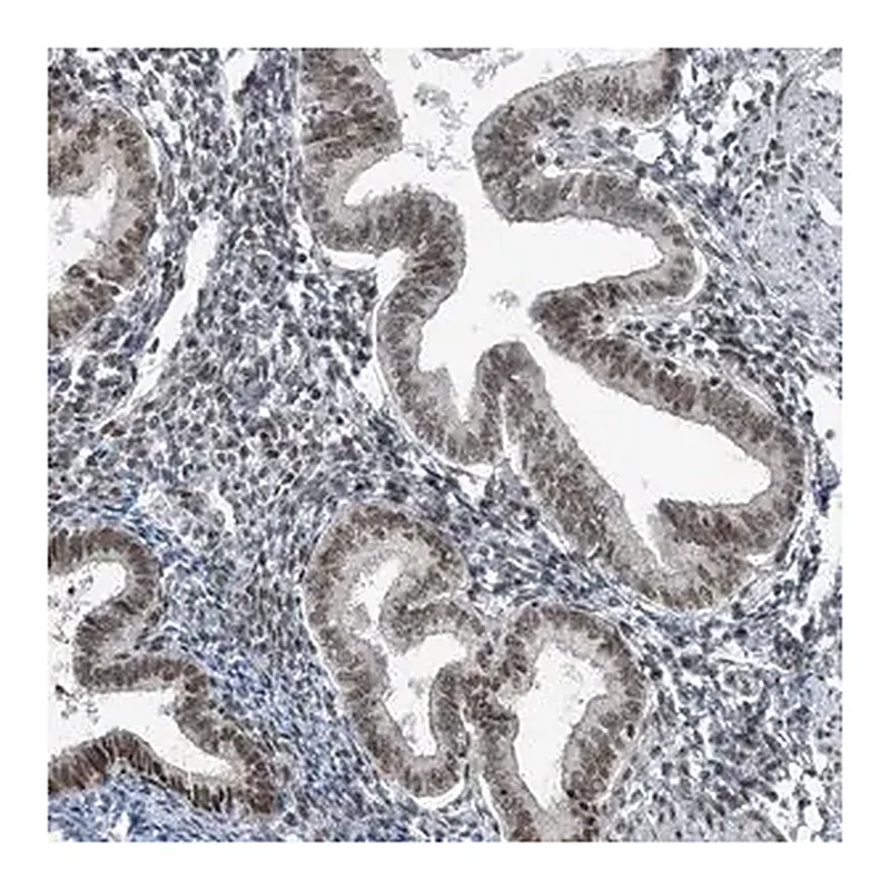 Merck Anti-YTHDC1 antibody produced in rabbit
