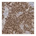 Merck Anti-KLF3 antibody produced in rabbit