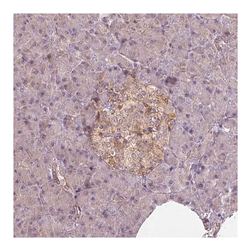 Merck Anti-GPRC5D antibody produced in rabbit
