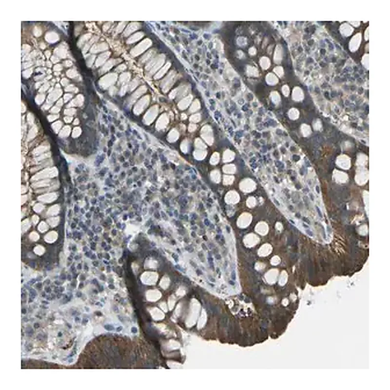 Merck Anti-PIEZO2 antibody produced in rabbit