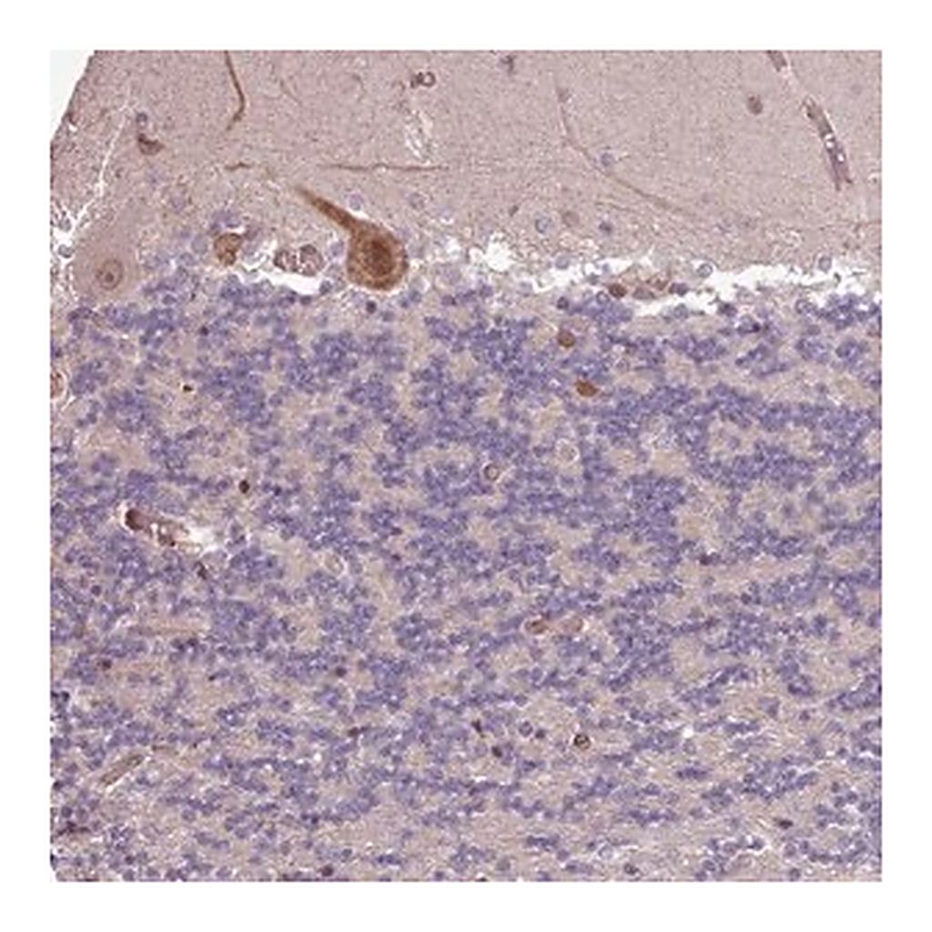 Merck Anti-CABP1 antibody produced in rabbit