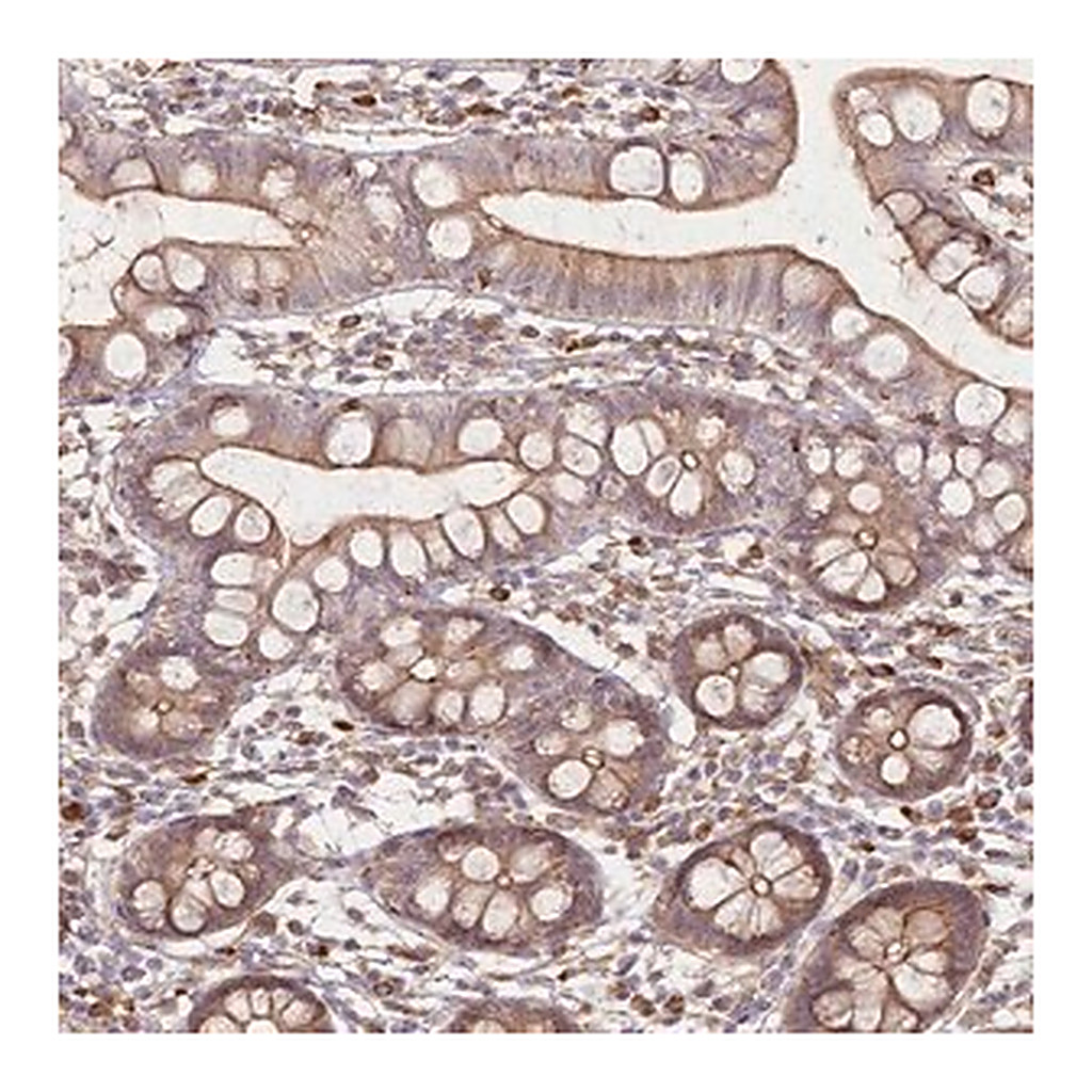 Merck Anti-FAM13A antibody produced in rabbit