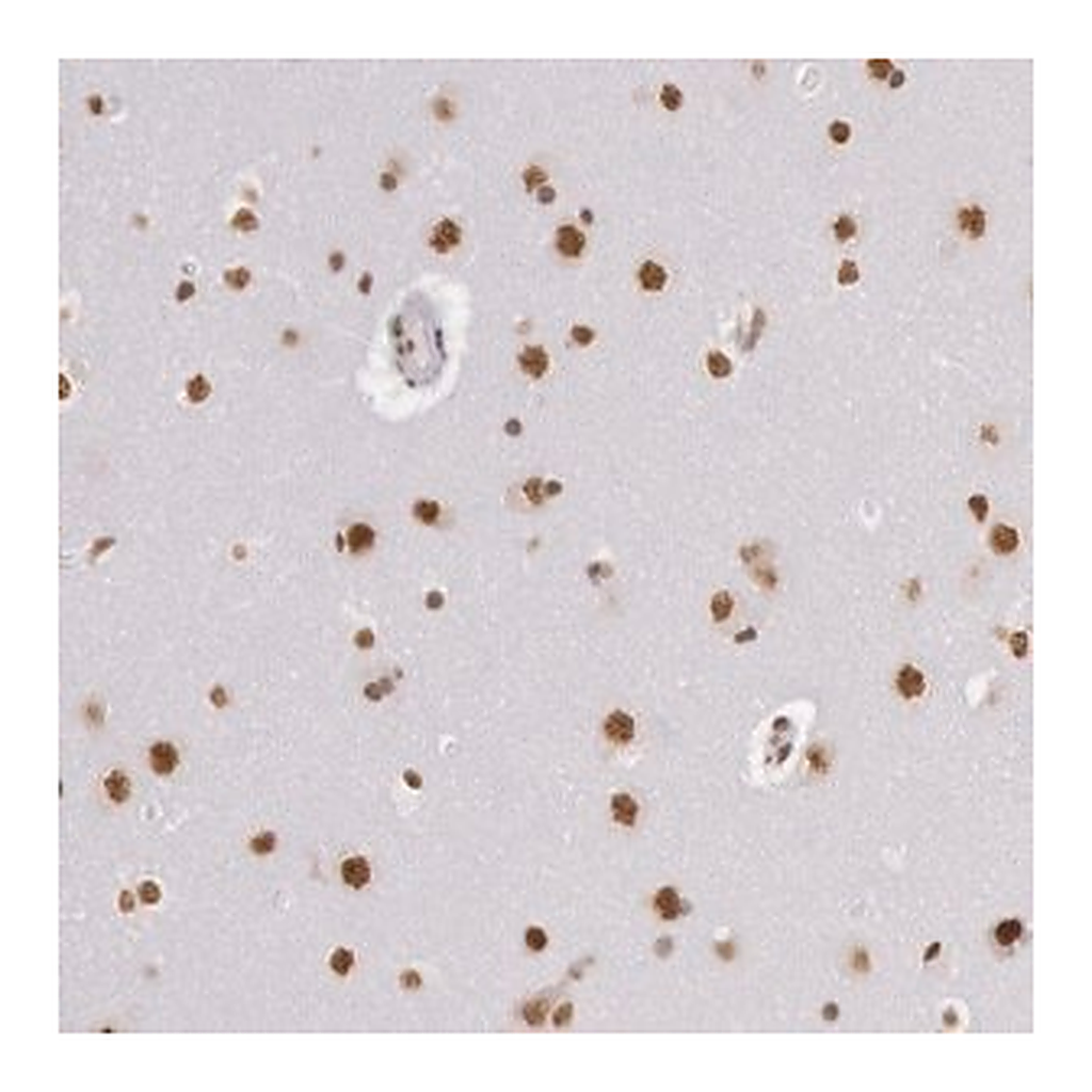 Merck Anti-HNRNPH2 antibody produced in rabbit