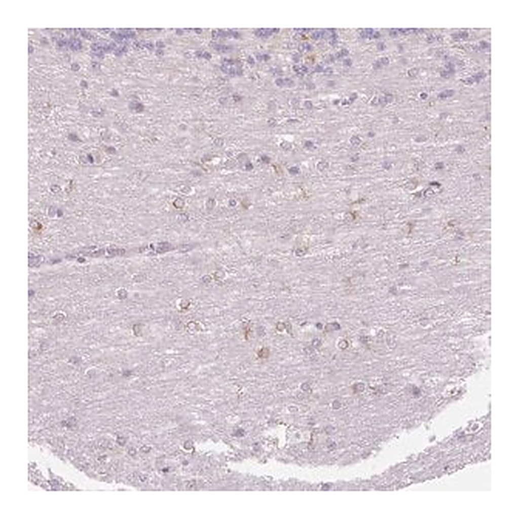 Merck Anti-FOCAD antibody produced in rabbit