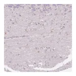 Merck Anti-FOCAD antibody produced in rabbit