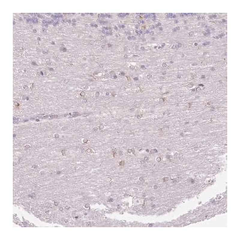 Merck Anti-FOCAD antibody produced in rabbit