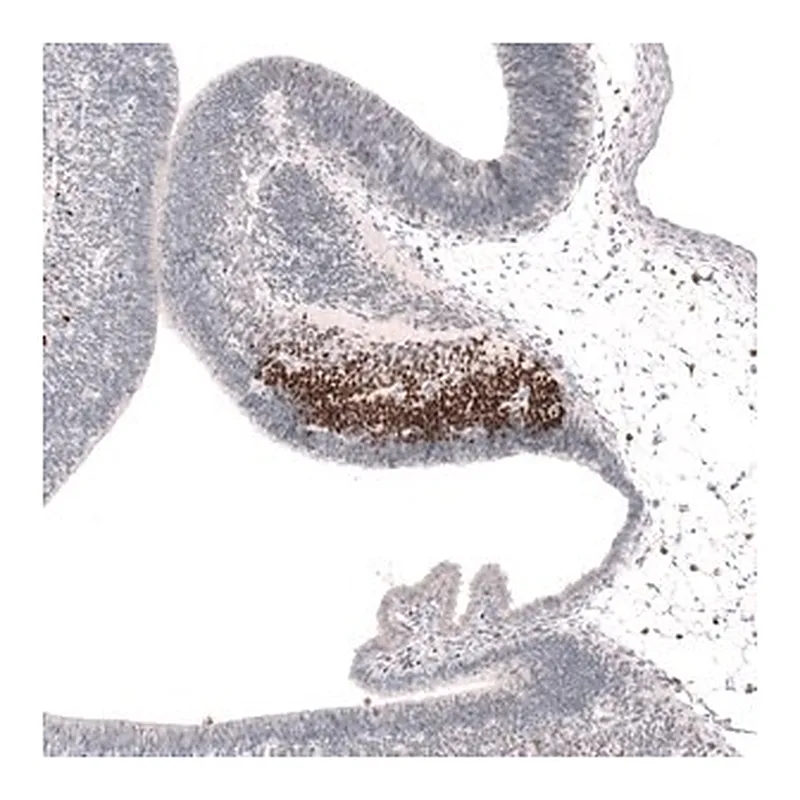Merck Anti-SKOR2 antibody produced in rabbit