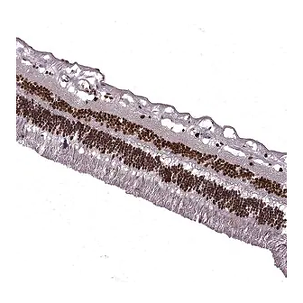 Merck Anti-RB1 antibody produced in rabbit