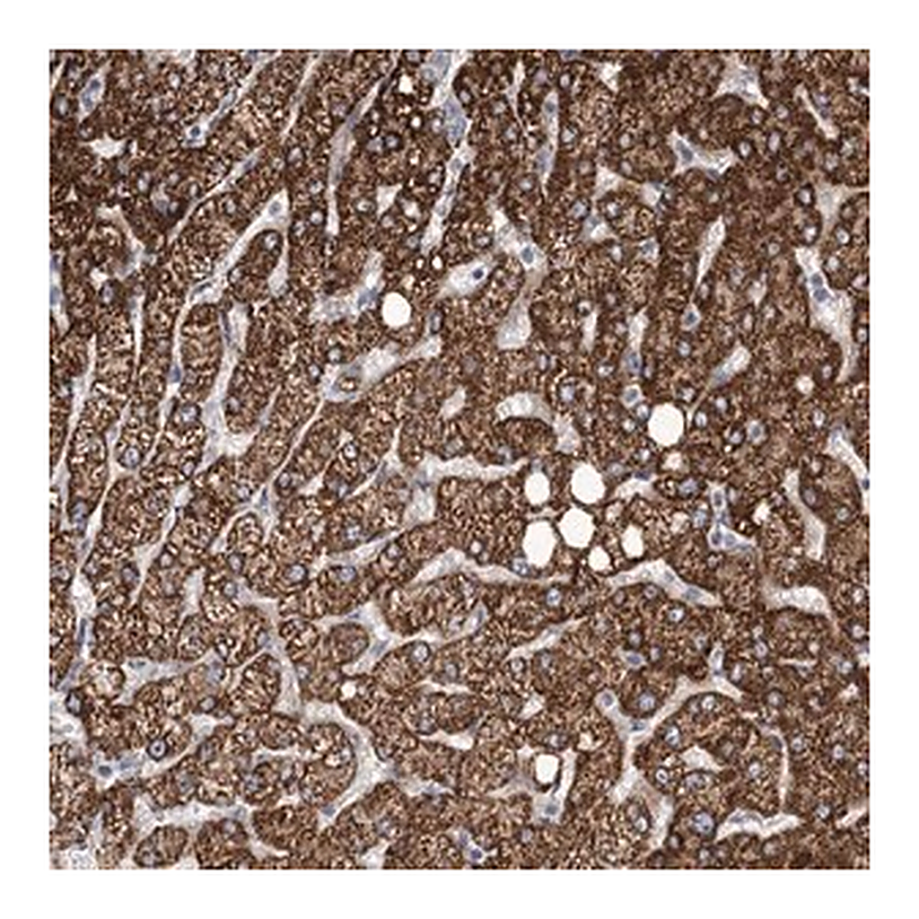 Merck Anti-ANGPTL3 antibody produced in rabbit