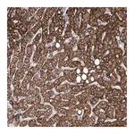 Merck Anti-ANGPTL3 antibody produced in rabbit