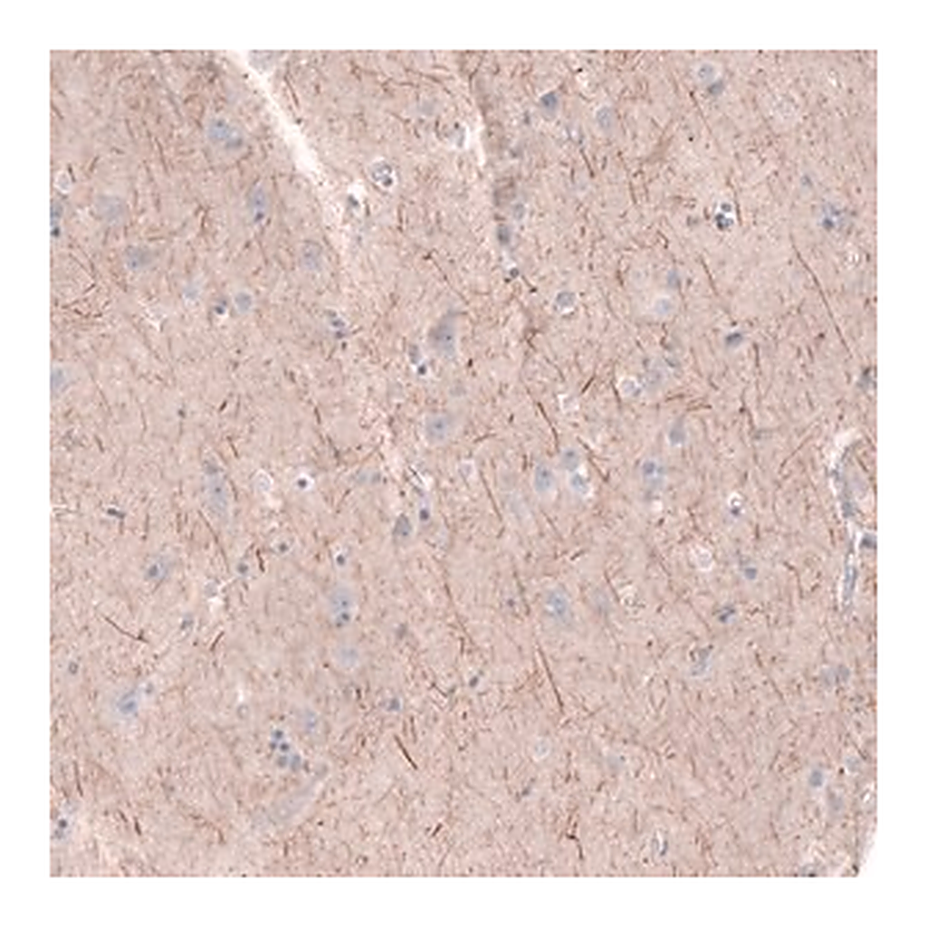 Merck Anti-PTPRK antibody produced in rabbit