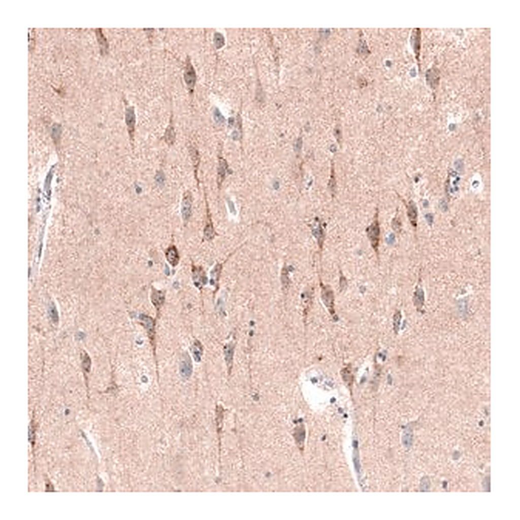 Merck Monoclonal Anti-CTGF antibody produced in mouse