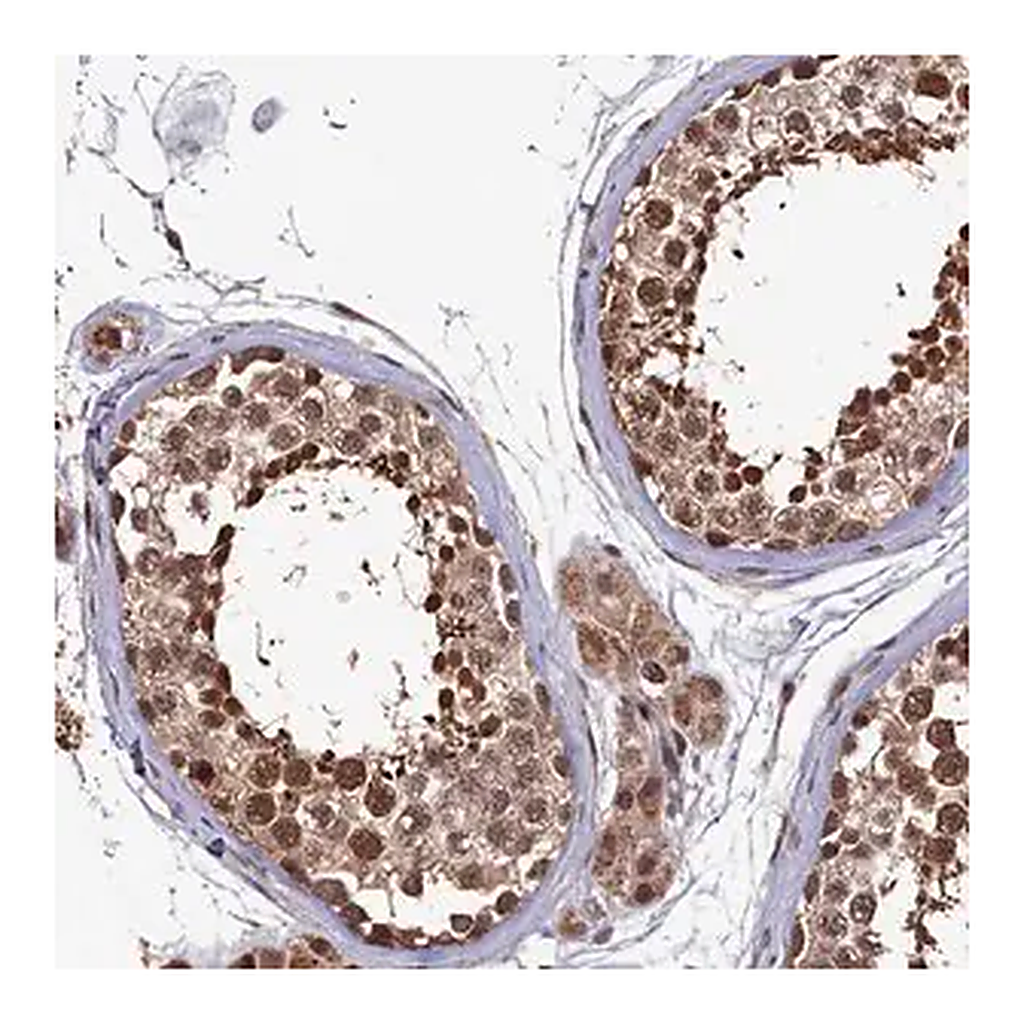 Merck Anti-CLPX antibody produced in rabbit
