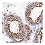 Merck Anti-CLPX antibody produced in rabbit