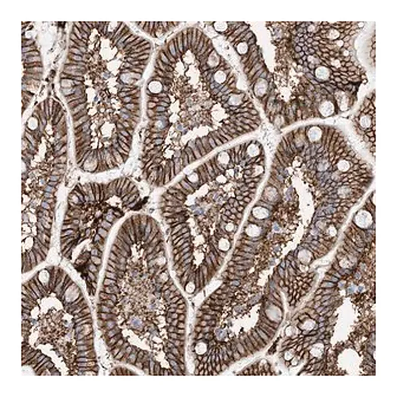 Merck Anti-ATP11C antibody produced in rabbit