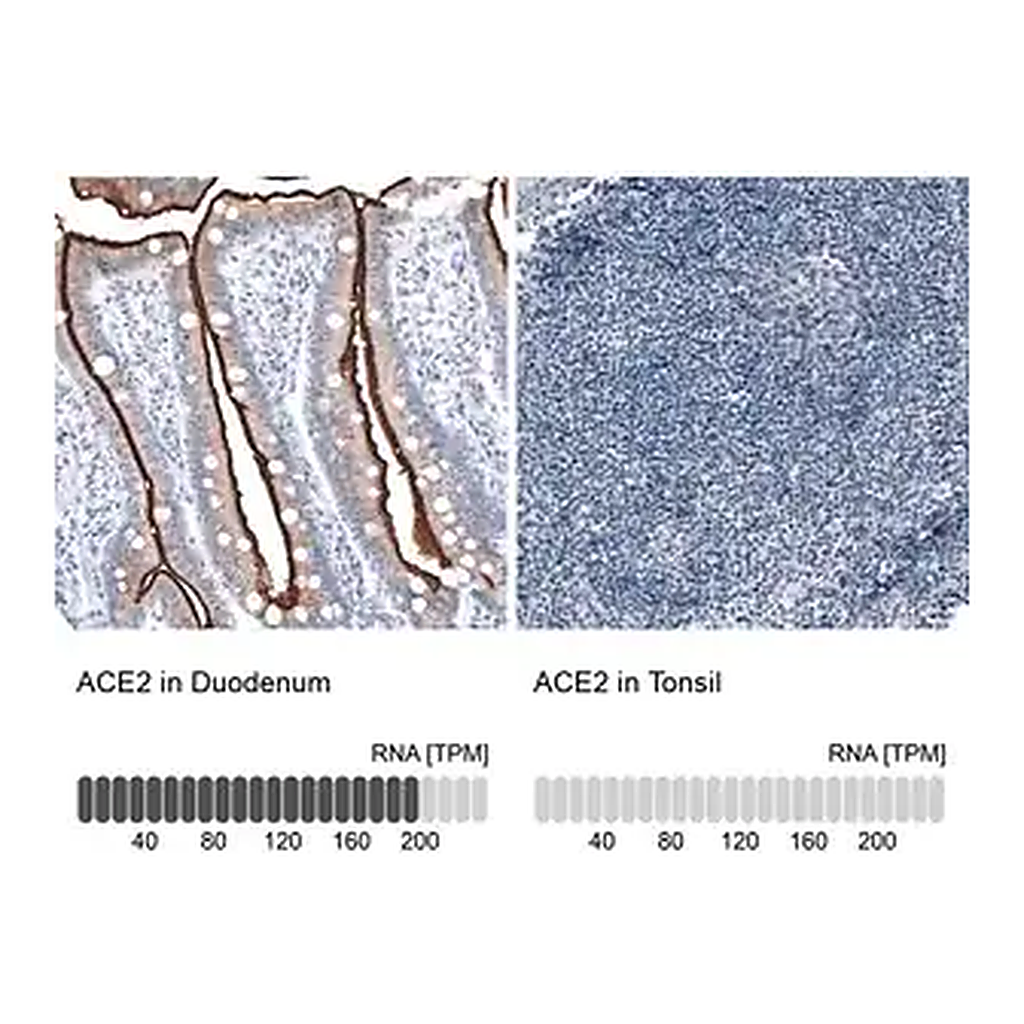 Merck Monoclonal Anti-ACE2 antibody produced in mouse
