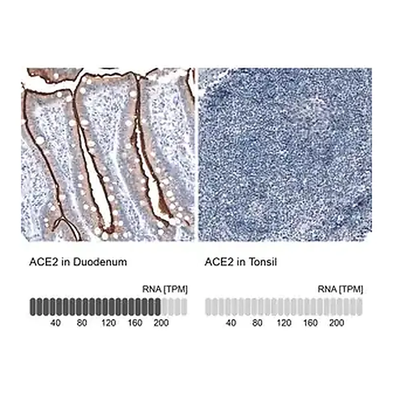 Merck Monoclonal Anti-ACE2 antibody produced in mouse