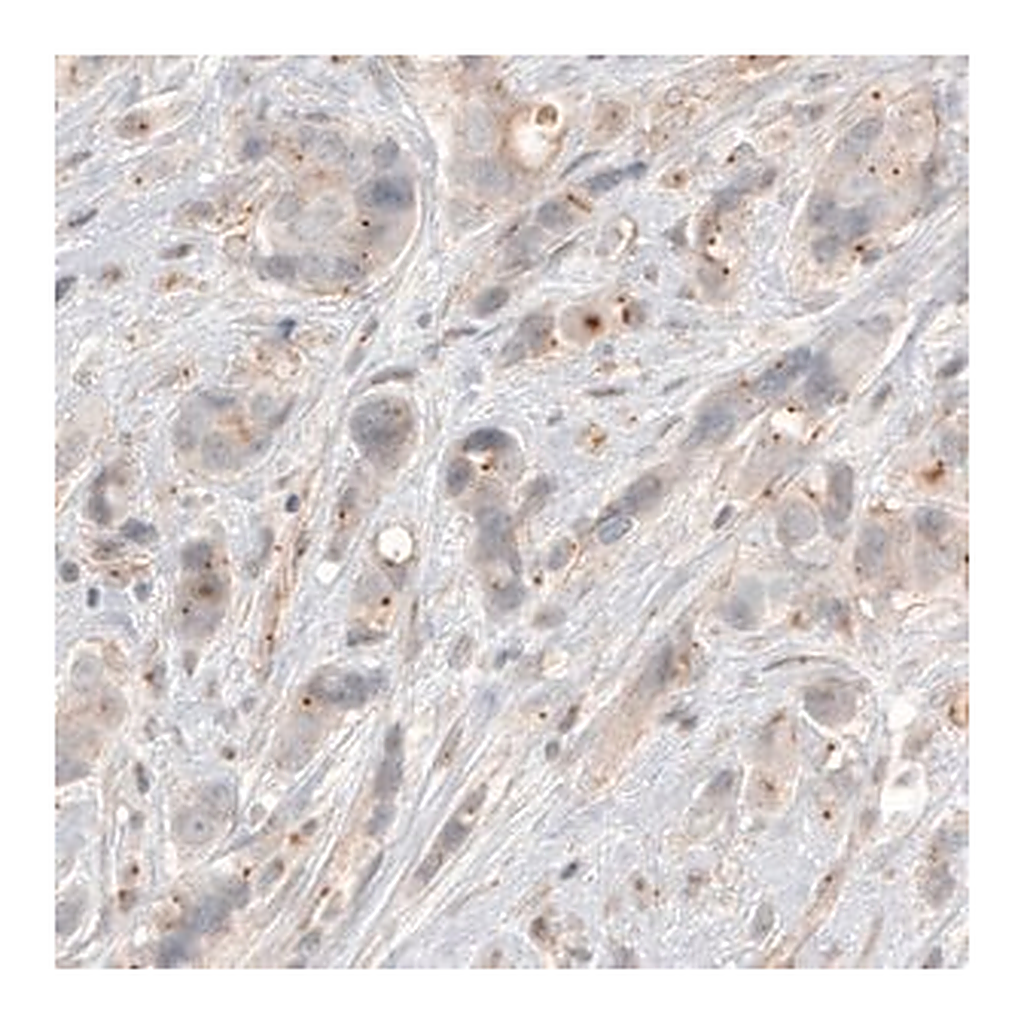 Merck Monoclonal Anti-CDK5RAP2 antibody produced in mouse