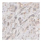 Merck Monoclonal Anti-CDK5RAP2 antibody produced in mouse