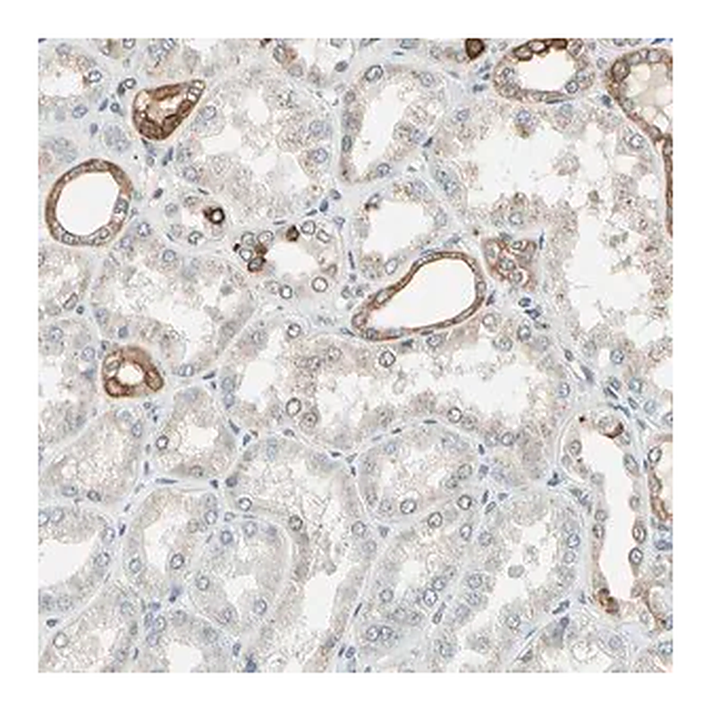 Merck Anti-PTH1R antibody produced in rabbit