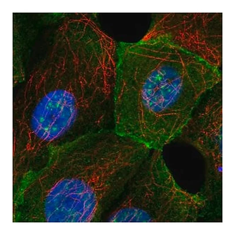 Merck Anti-MAPT antibody produced in rabbit