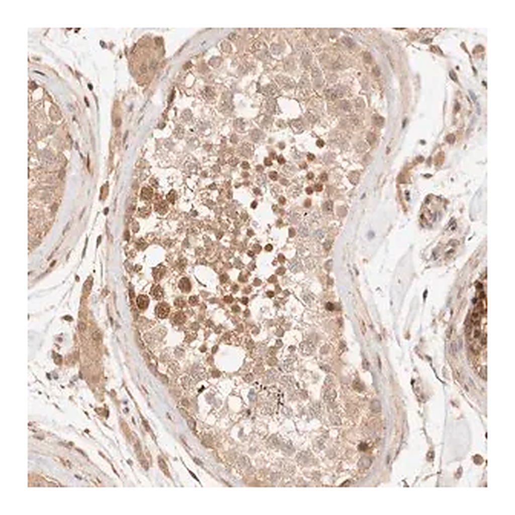 Merck Anti-TRIM11 antibody produced in rabbit