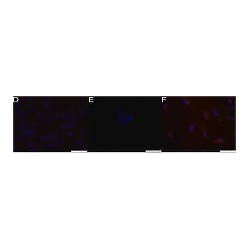 Merck Anti-Stage-Specific Embryonic Antigen-1 Antibody, clone MC-480