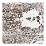 Merck ANTI-EXD2 antibody produced in rabbit