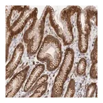 Merck Anti-RNF213 antibody produced in rabbit